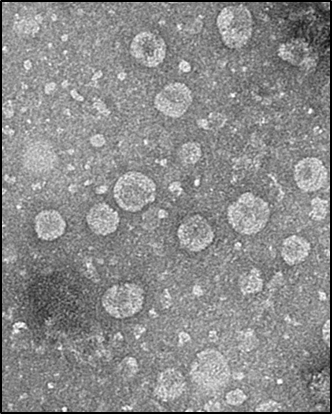 ▲ 녹차유산균 엑소솜(L. plantarum exosome)_전자현미경촬영(Bio-TEM)ⓒ아모레퍼시픽