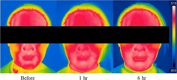 ▲ 마스크 착용시 피부온도 변화ⓒ아모레퍼시픽