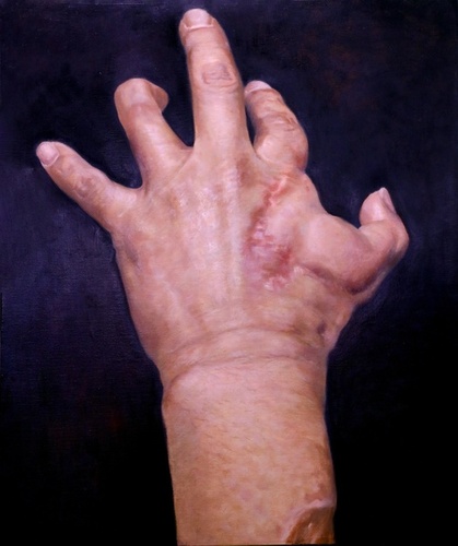 ▲ 김기환 화가의 작품 ‘움직이지 않는 손가락’으로 2002년 제2연평해전 당시 부상을 당한 권기형 상병의 왼손을 유화로 표현했다.ⓒ칠곡군