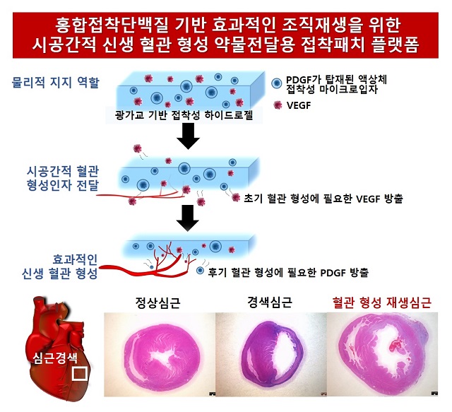 ▲ 홍합접착단백질 기반 효과적인 조직재생을 위한 시공간적 신생 혈관 형성 약물전달용 접착패치 플랫폼.ⓒ포스텍