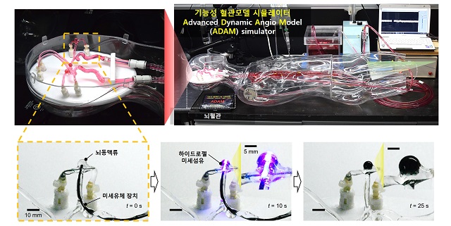 ▲ POSTECH 공동연구팀은 구조 강화된 광가교성 생체친화 소재를 물질을 미세섬유 형태로 활용한 신개념 뇌동맥류 치료법을 개발했다.ⓒ포스텍