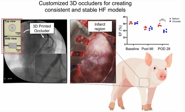 ▲ 돼지 심근경색 모델 제작용 맞춤형 3D 프린팅 폐색기. 만성 심근경색 모델을 유발시킬 수 있는 획기적인 도구로 활용될 수 있다.ⓒ포스텍