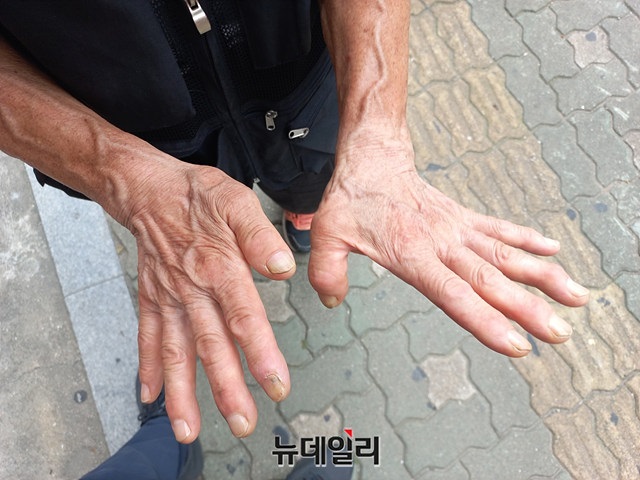 ▲ 폐지수거 노인의 손. 자주 다쳐 퉁퉁 붓고 거칠다. ⓒ이건율 기자