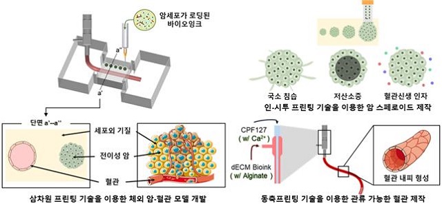 ▲ 인-시투 프린팅 기술을 이용한 암-혈관 모델 제작 개념도.ⓒ포스텍