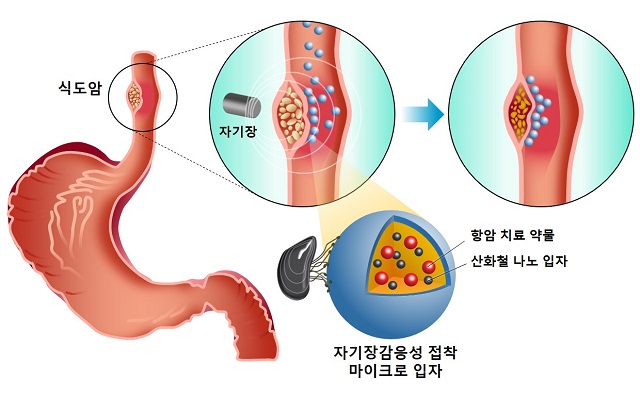 ▲ 식도 환경에서 단백질 마이크로입자의 자기장 감응성 및 접착성을 이용한 항암 약물치료 모식도.ⓒ포스텍