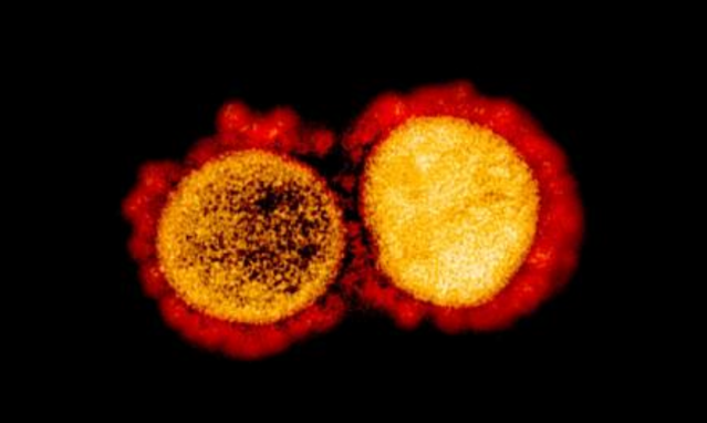 ▲ 코로나19 XE변이. ⓒ미국 국립 알레르기·전염병 연구소(NIAID)