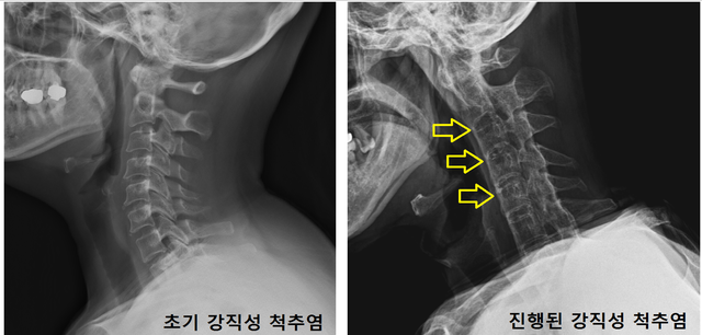 ▲ ⓒ국민건강보험공단