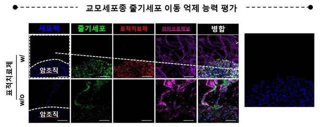 ▲ ⓒ세브란스병원