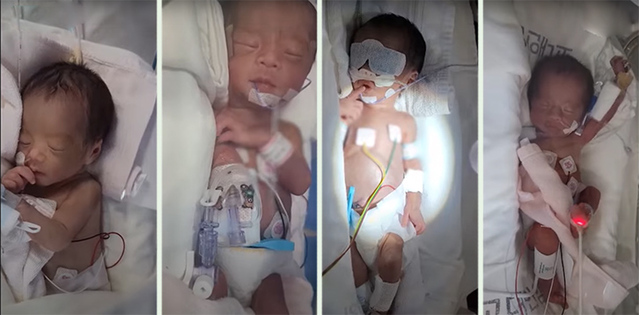 ▲ 지난달 24일 태어난 네쌍둥이 모습. ⓒ포스코