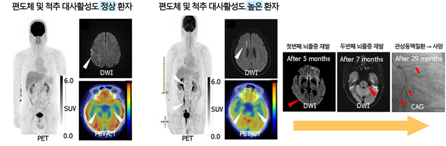 ▲ ⓒ서울대병원