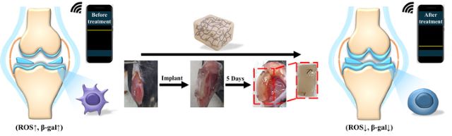 ▲ 전도성 하이드로겔을 활용한 노화 연골세포 진단 및 퇴행연골 치료 모식도.ⓒ한국교통대