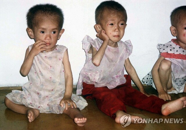 ▲ 1997년 자료사진. 영양실조에 걸린 북한 아이들. ⓒ연합뉴스