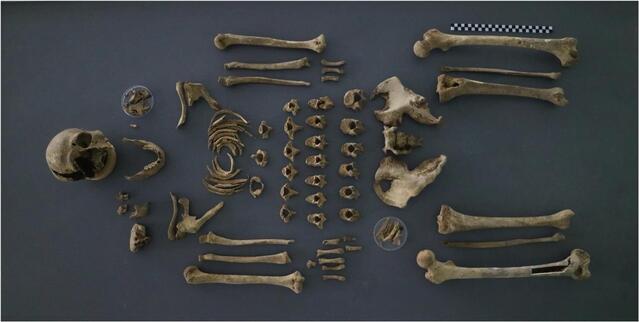 ▲ 고 전복희 하사 유해의 전체 골격 사진. ⓒ국방부 제공