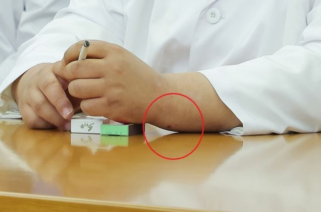 ▲ 북한 김정은 국무위원장의 왼쪽 손목 부분에 검은 반점이 포착돼 건강 이상설이 제기되고 있다. ⓒ조선중앙통신·연합뉴스