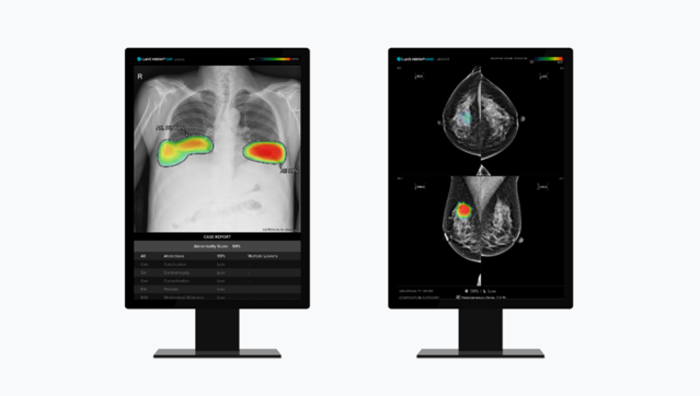 ▲ 루닛 흉부 엑스레이 AI 영상분석 솔루션 '루닛 인사이트 CXR'(왼쪽)과 유방촬영술 AI 영상분석 솔루션 '루닛 인사이트 MMG'. ⓒ루닛