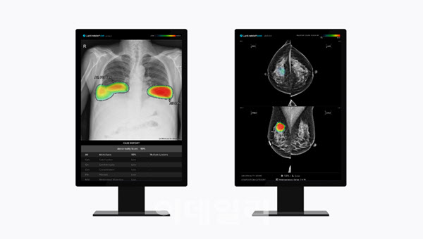 ▲ 루닛 흉부 엑스레이 AI 영상분석 솔루션 '루닛 인사이트 CXR'(왼쪽)과 유방촬영술 AI 영상분석 솔루션 '루닛 인사이트 MMG' ⓒ루닛