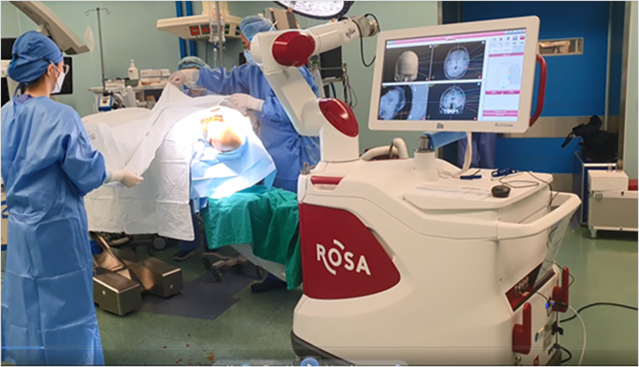 ▲ 삼성서울병원 의료진들이 ROSA 뇌전증 수술 로봇을 진행하고 있다. ⓒ삼성서울병원