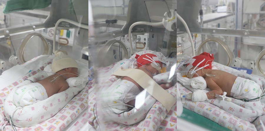 ▲ 계명대학교 동산병원(병원장 류영욱)에서 귀중한 생명인 세쌍둥이가 탄생했다. (왼쪽부터 첫째, 둘째, 셋째).ⓒ계명대 동산병원