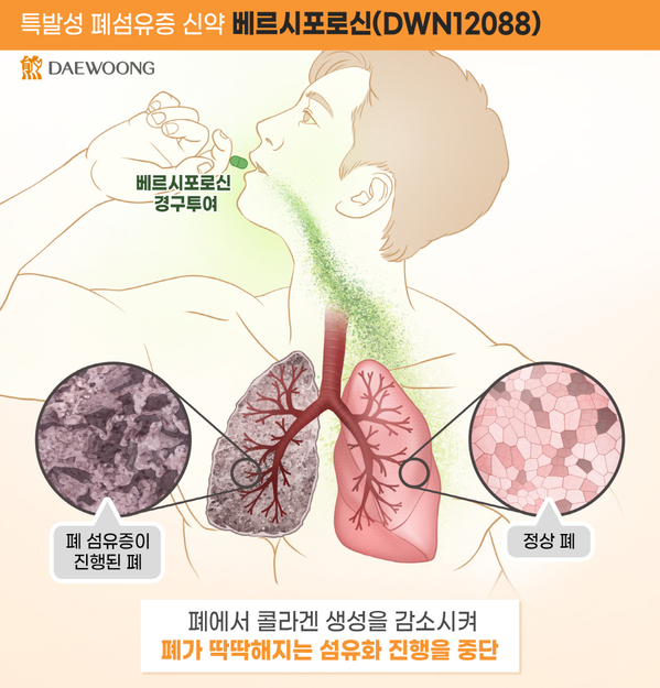 ▲ 베르시포로신(DWN12088) 작용 기전.ⓒ대웅제약