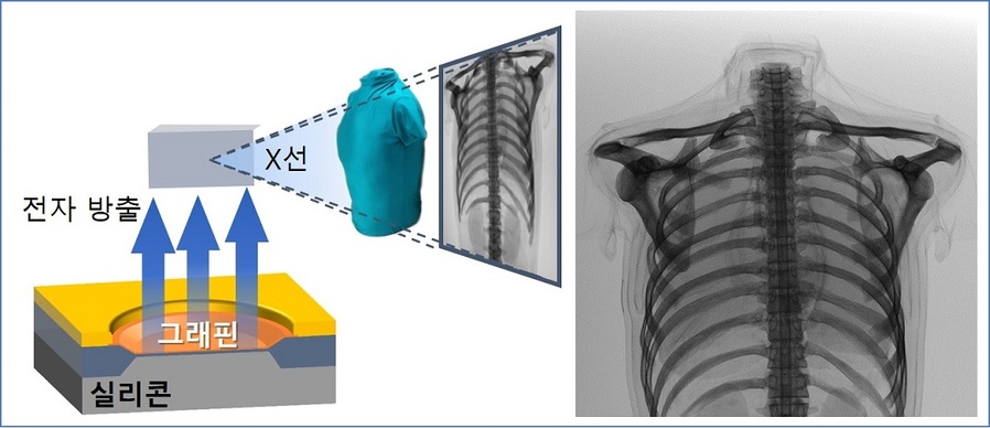 ▲ 실리콘에서 주입된 전자가 그래핀을 통해 방출된 후 가속되어 금속 표면과 충돌하면 X선이 발생함. 그래핀과 반도체공정으로 충분한 선량의 X선을 발생시켜 흉부팬텀의 이미징에 성공.ⓒ세종대