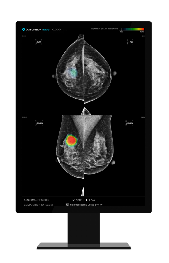 ▲ 루닛 유방촬영술 AI 영상분석 솔루션 '루닛 인사이트 MMG' ⓒ루닛