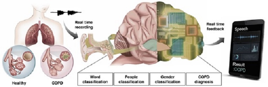 ▲ 인공지능 기반 폐 질환 중증도 분석이 가능한 음성 인식 시스템 개발 연구 이미지.ⓒ성균관대