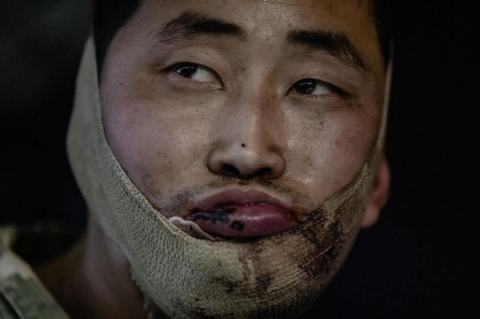 ▲ 볼로디미르 젤렌스키 우크라이나 대통령이 생포된 북한군 2명의 모습을 담은 사진을 11일(현지 시간) 공식 SNS를 통해 공개했다. 사진은 얼굴에 부상당한 북한군. ⓒ볼로디미르 젤렌스키 대통령 공식 SNS 제공