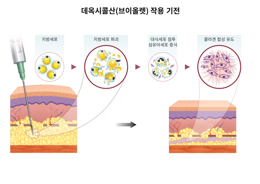 ▲ 데옥시콜산 작용기전. ⓒ대웅제약