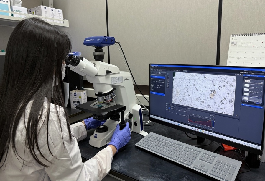 ▲ 충북보건환경연구원이 요충 검경을 하고 있다. ⓒ충북보건환경연구원