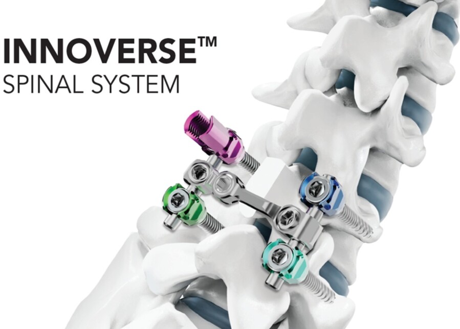 ▲ 시지메드텍의 척추 고정 장치 ‘이노버스 스파이널 시스템 ⓒ시지메드텍