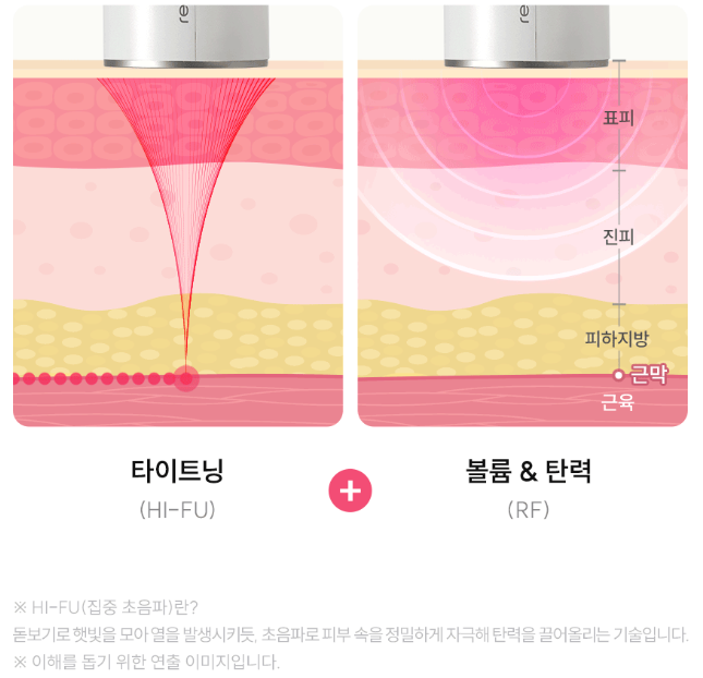▲ 쿠쿠의 HI-FU 기술과 고주파 기능이 피부 진피층부터 근막층까지 도달하는 연출 이미지 ⓒ쿠쿠 홈페이지 갈무리