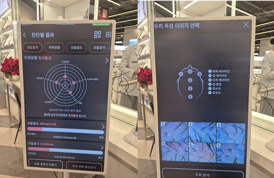 ▲ 두피 측정 결과 ⓒ김보라