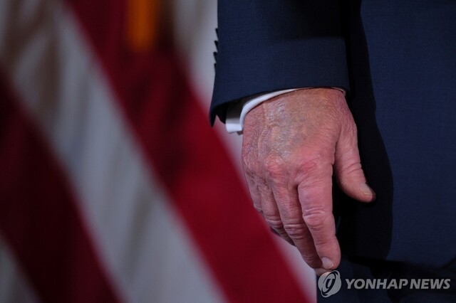 ▲ 멍이 확인되는 도널드 트럼프 미국 대통령의 손. 출처=로이터ⓒ연합뉴스