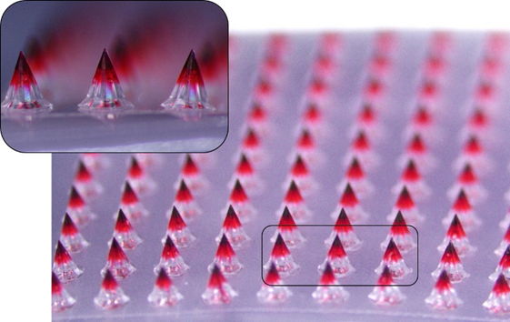 ▲ 대웅테라퓨틱스가 개발한 마이크로니들 패치의 약물층을 시각적으로 표현하기 위해 색소를 첨가하고 6.7배 확대 촬영한 모습 ⓒ대웅제약