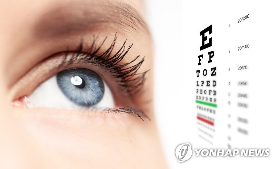 ▲ 시력검사 이미지. ⓒ연합뉴스