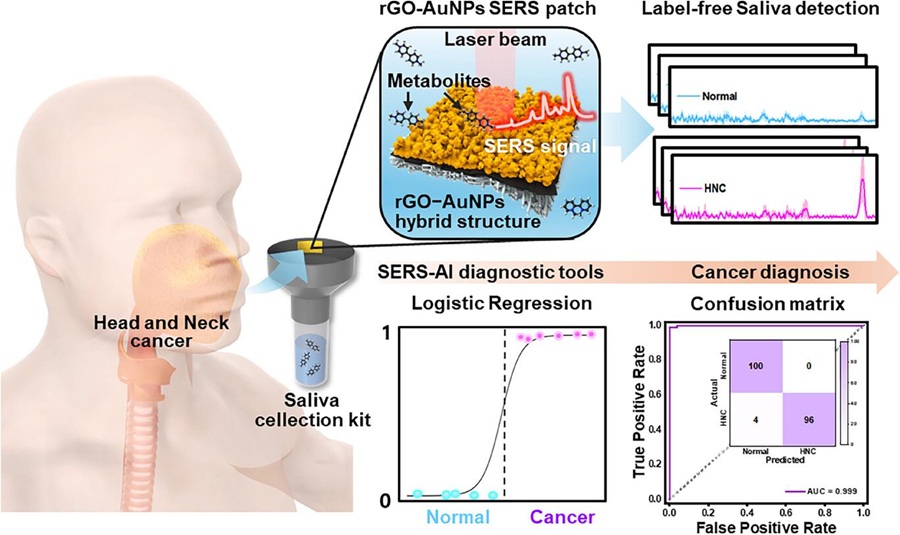 ▲ 침을 이용한 두경부암 진단 개념도.ⓒ고려대