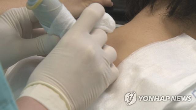 ▲ 대상포진 치료. 연합뉴스TV 제공. ⓒ연합뉴스