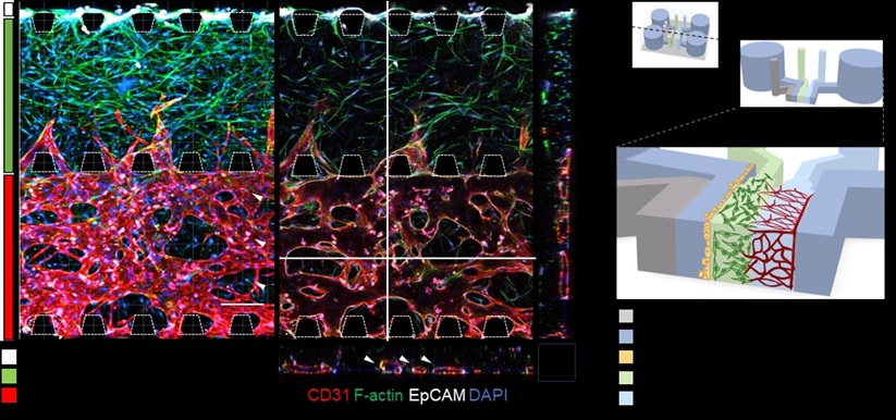 ▲ 환자 세포 유래 자궁내막 칩 구성도.ⓒ성균관대