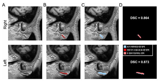 ▲ ⓒ분당서울대병원