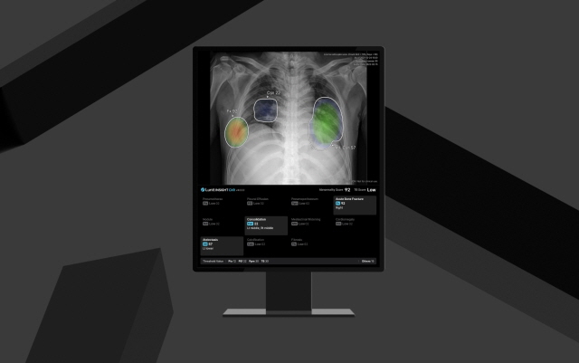▲ '루닛 인사이트 CXR4'. ⓒ루닛