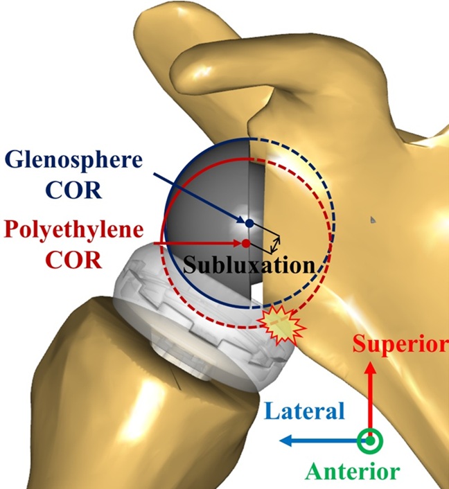 ▲ 견갑골 충돌 및 관절 아탈구 관련 논문 이미지.ⓒ서강대