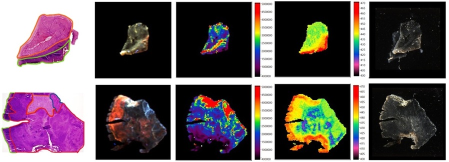 ▲ AI와 자가형광 분광법을 결합해 위암 조직을 정밀 분석한 이미지.ⓒ국민대