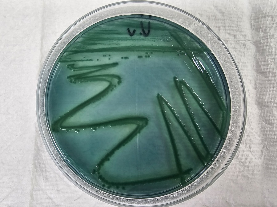 ▲ 비브리오패혈증균 검사ⓒ전라남도 제공