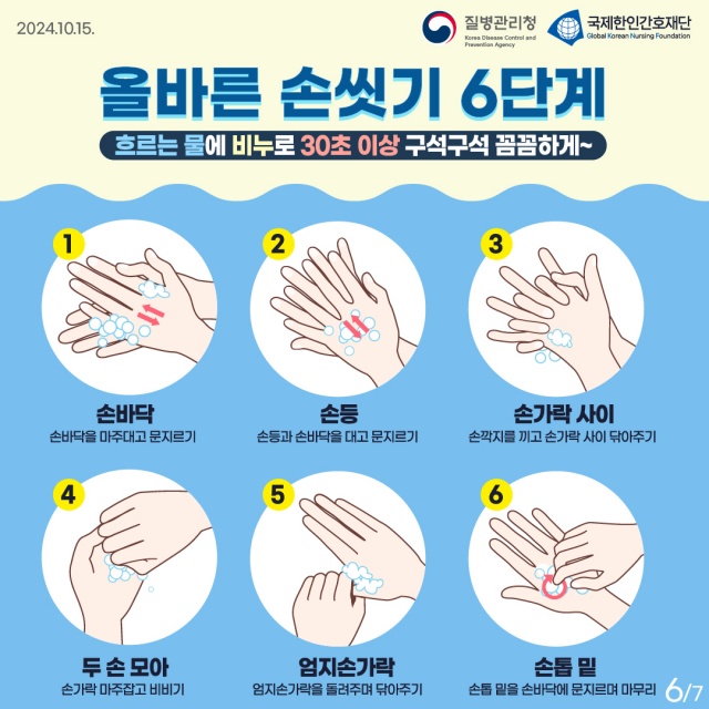 ▲ 수두 예방수칙 안내문ⓒ오산시 제공