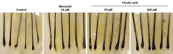 ▲ ⓒLG생활건강