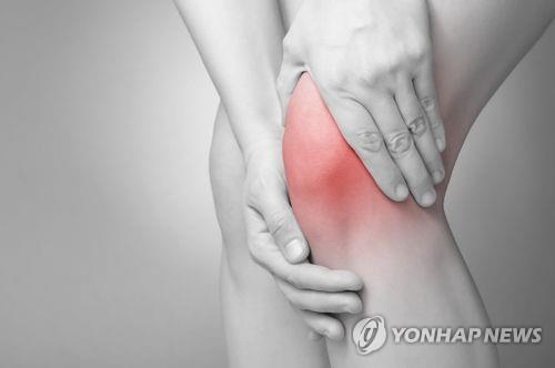 ▲ 퇴행성 관절염. ⓒ연합뉴스