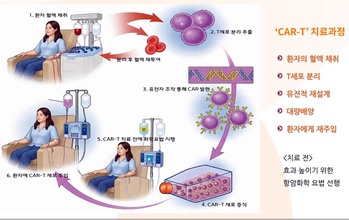 큐로셀, 국산 1호 CAR-T '림카토주' 허가 … 효과·가격·한계는